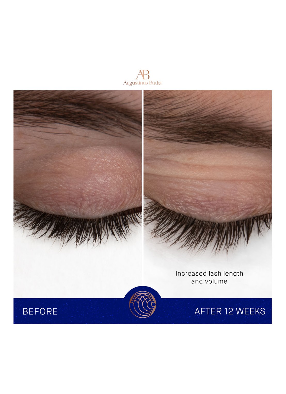 Augustinus Bader The Eyebrow & Lash Enhancing Serum - wenkbrauw- en wimper serum - detail 3 undefined