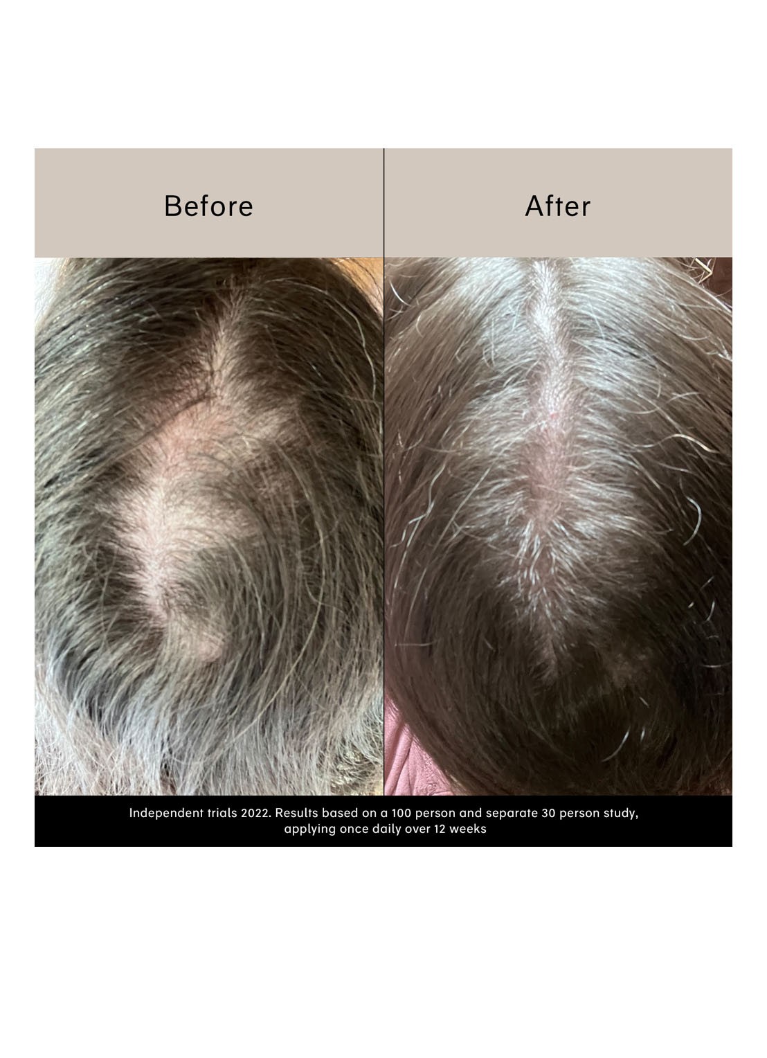 Chāmpo Pitta Growth Serum - haarserum - detail 2 undefined