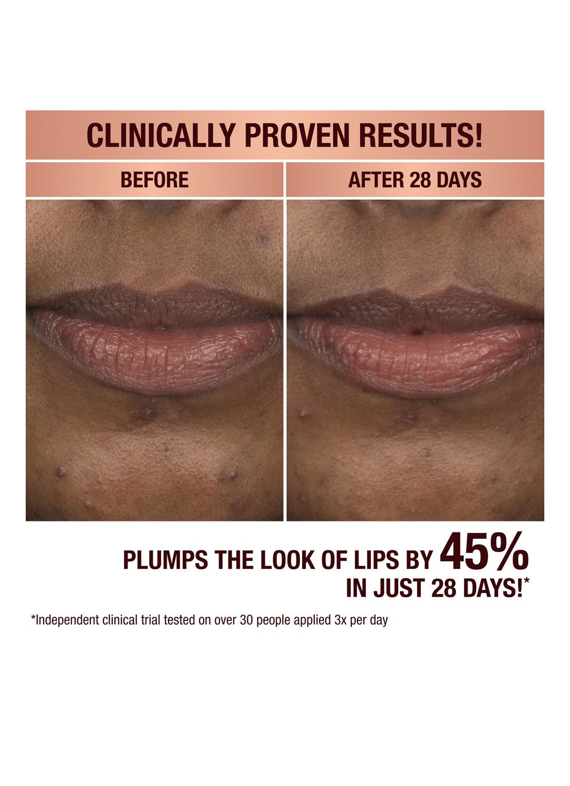 Charlotte Tilbury Life Changing Lip Mask - lipmasker - detail 4 magic sheer glow