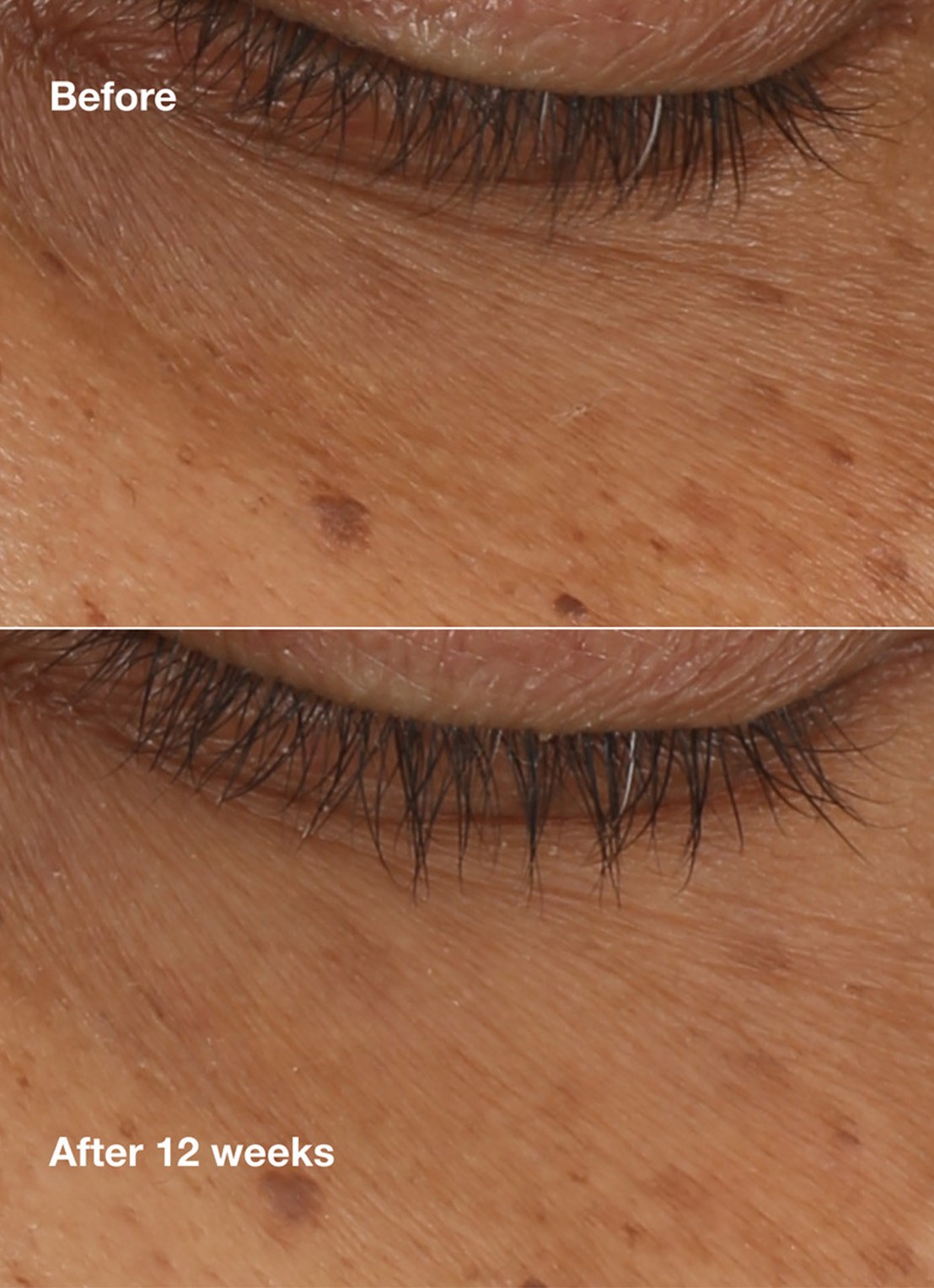 Clinique All About Eyes Brightening Serum Concentrate - oogserum - detail 4 undefined