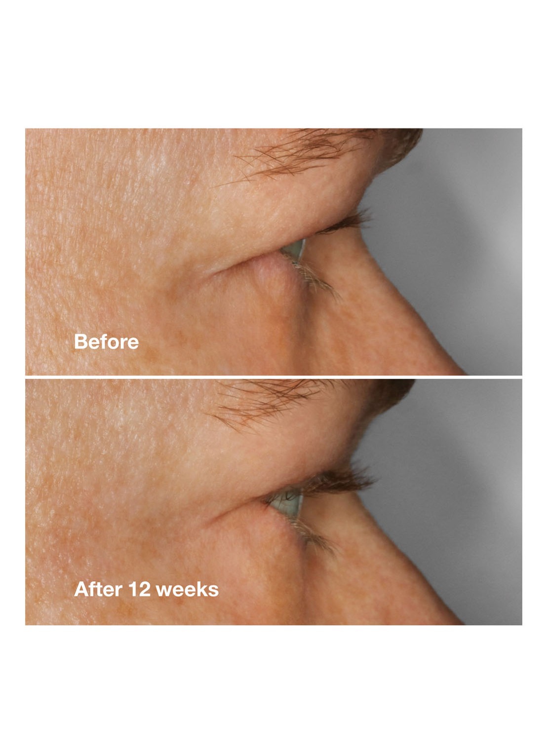Clinique High Impact Lash Amplifying Serum - wimperserum - detail 3 undefined