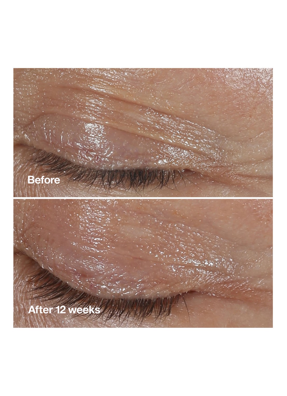 Clinique Smart Clinical Repair™ Wrinkle Correcting Eye Cream - oogcrème - detail 2 undefined