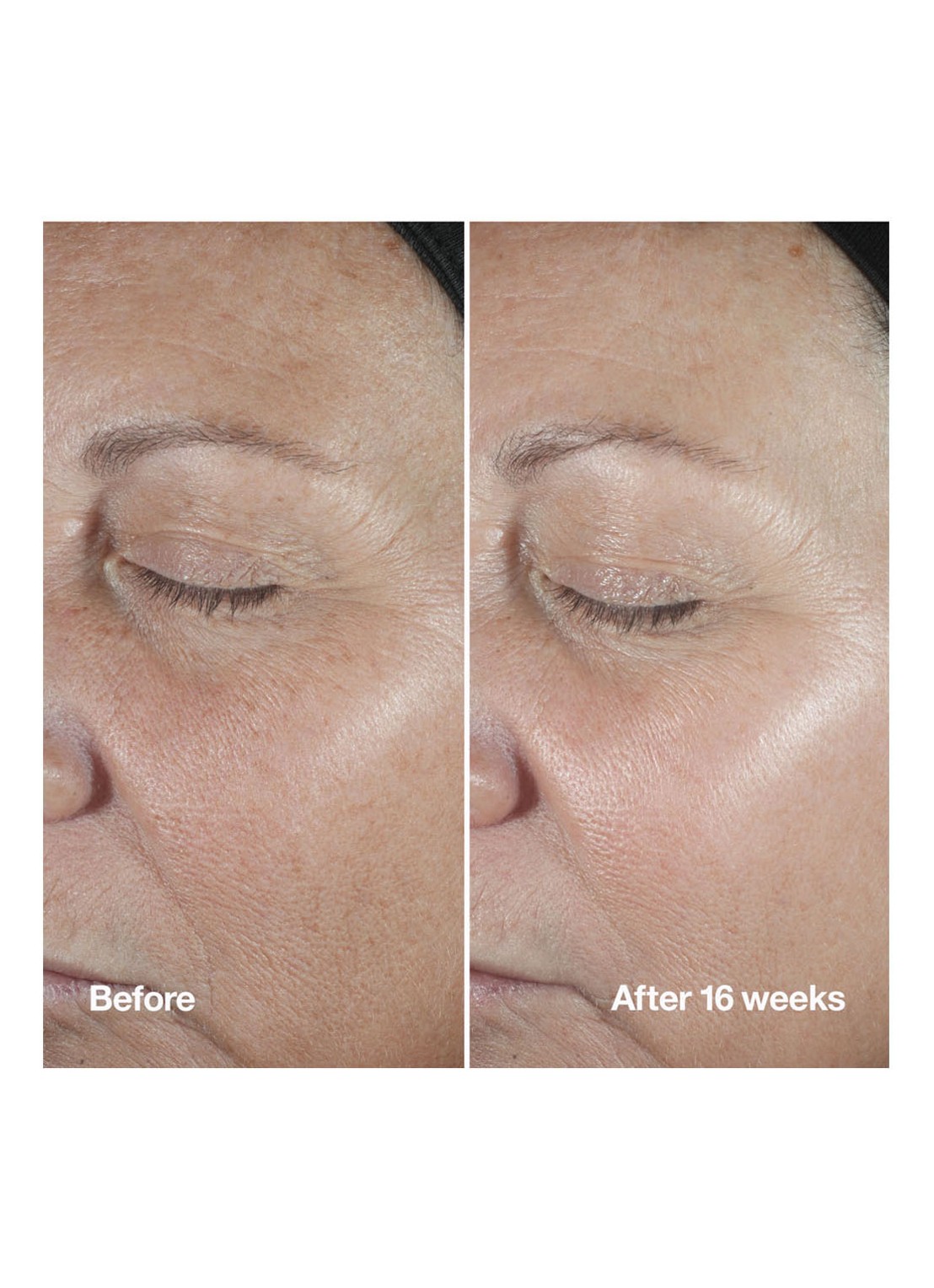 Clinique Smart Clinical Repair™ Wrinkle Correcting Serum - Limited Edition serum - detail 3 undefined