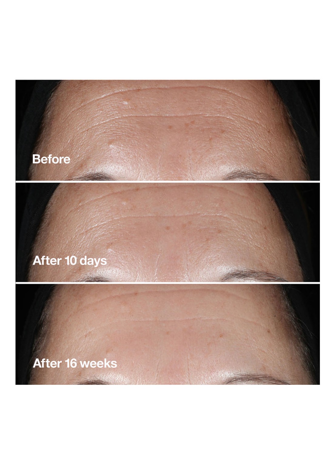 Clinique Smart Clinical Repair™ Wrinkle Correcting Serum - Limited Edition serum - detail 4 undefined