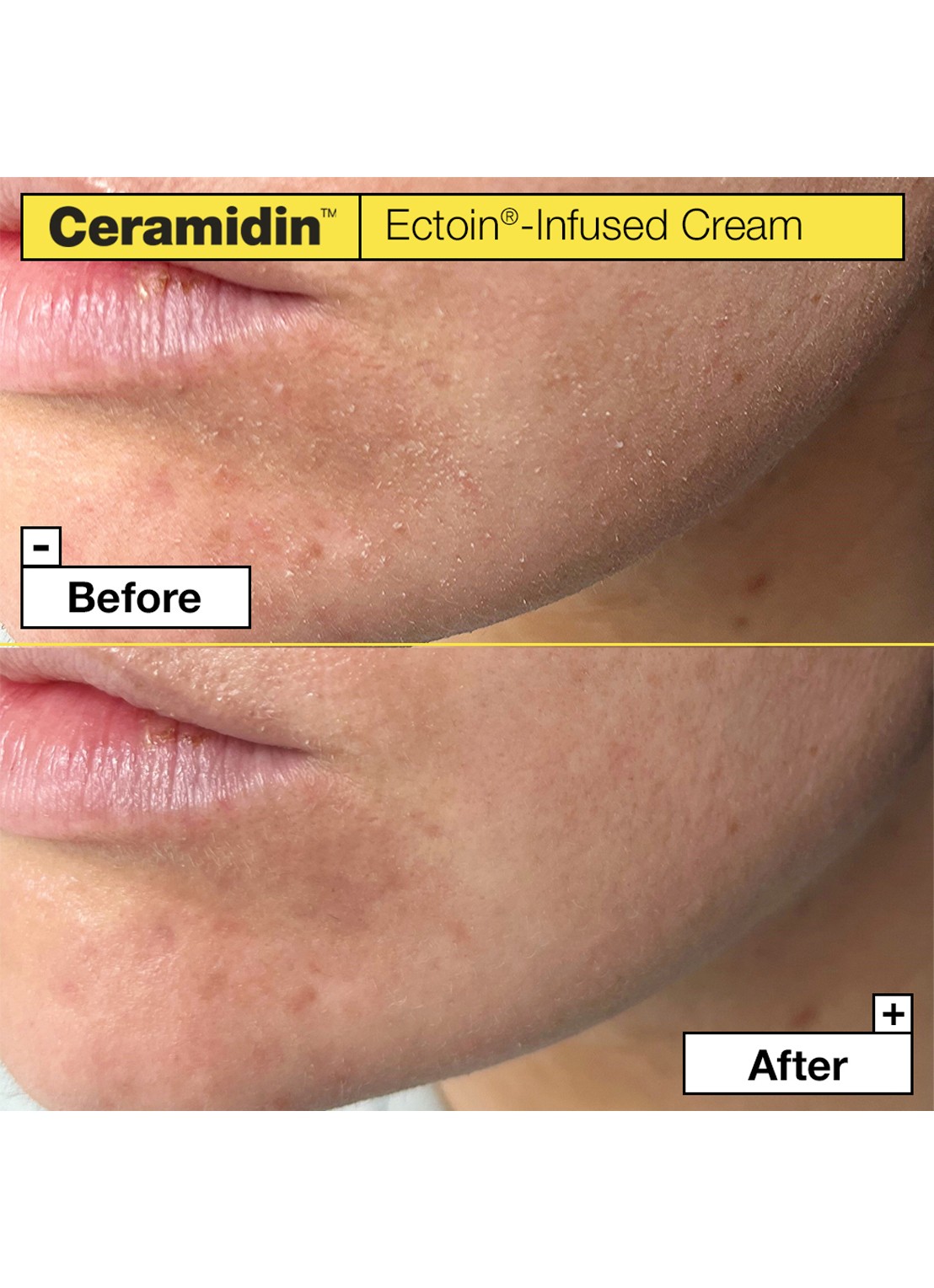 Dr. Jart+ CERAMIDIN™ Ectoin-Infused Cream  - detail 2 undefined
