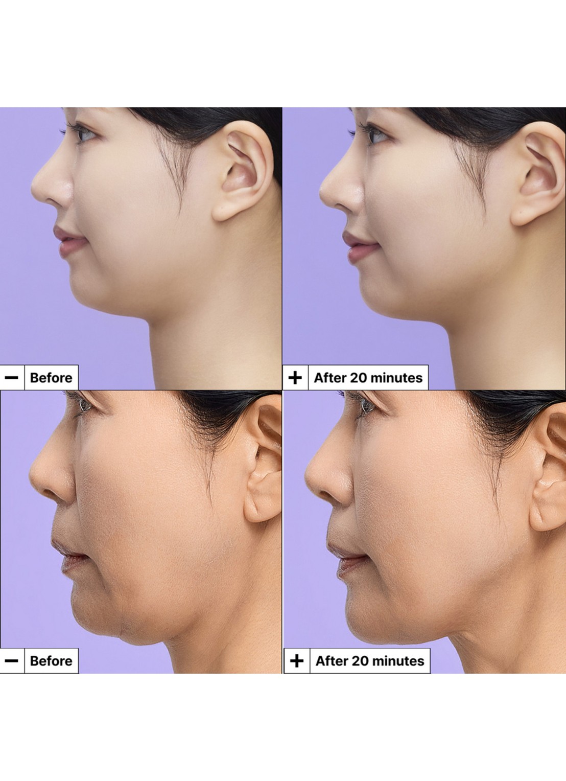 Dr. Jart+ Cryo-V Sculpt Jawline Lifting Mask - gezichtsmasker - detail 3 undefined