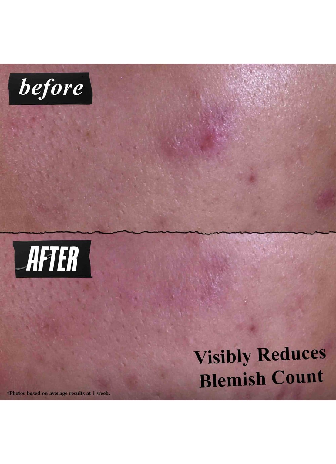 Kiehl's Gently Effective Blemish-Treating Cleansing Paste - gezichtsreiniger - detail 2 undefined