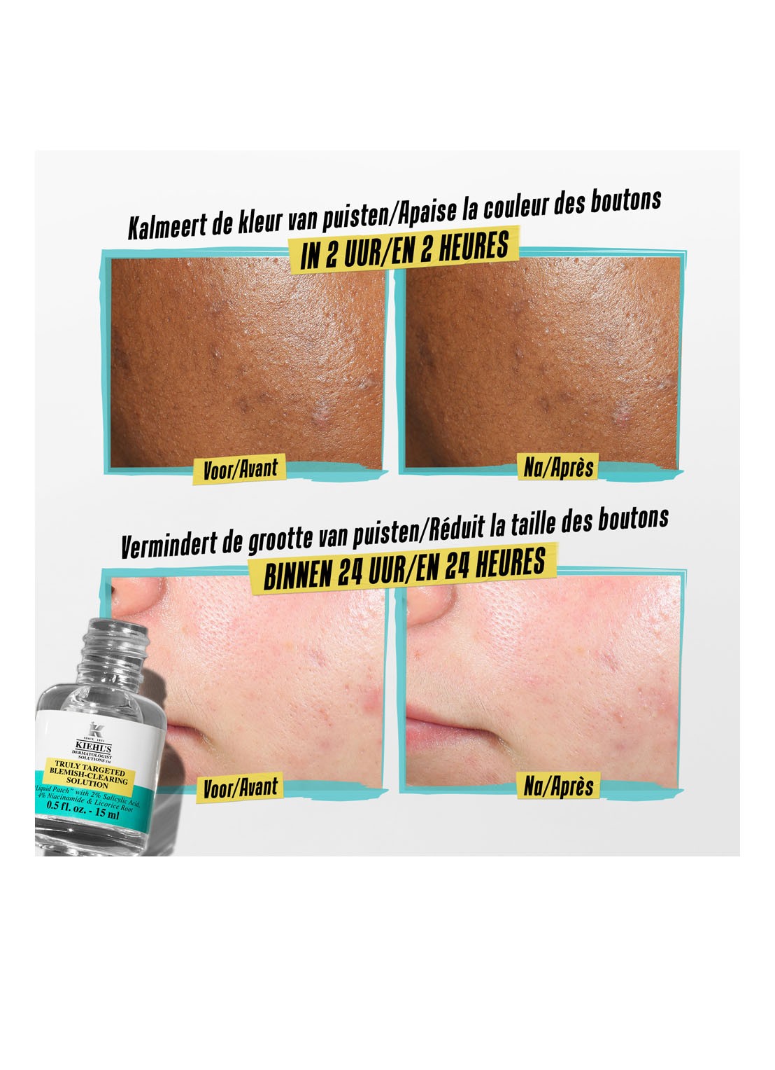 Kiehl's Truly Targeted Blemish-Clearing Solution - gezichtsserum - detail 2 undefined
