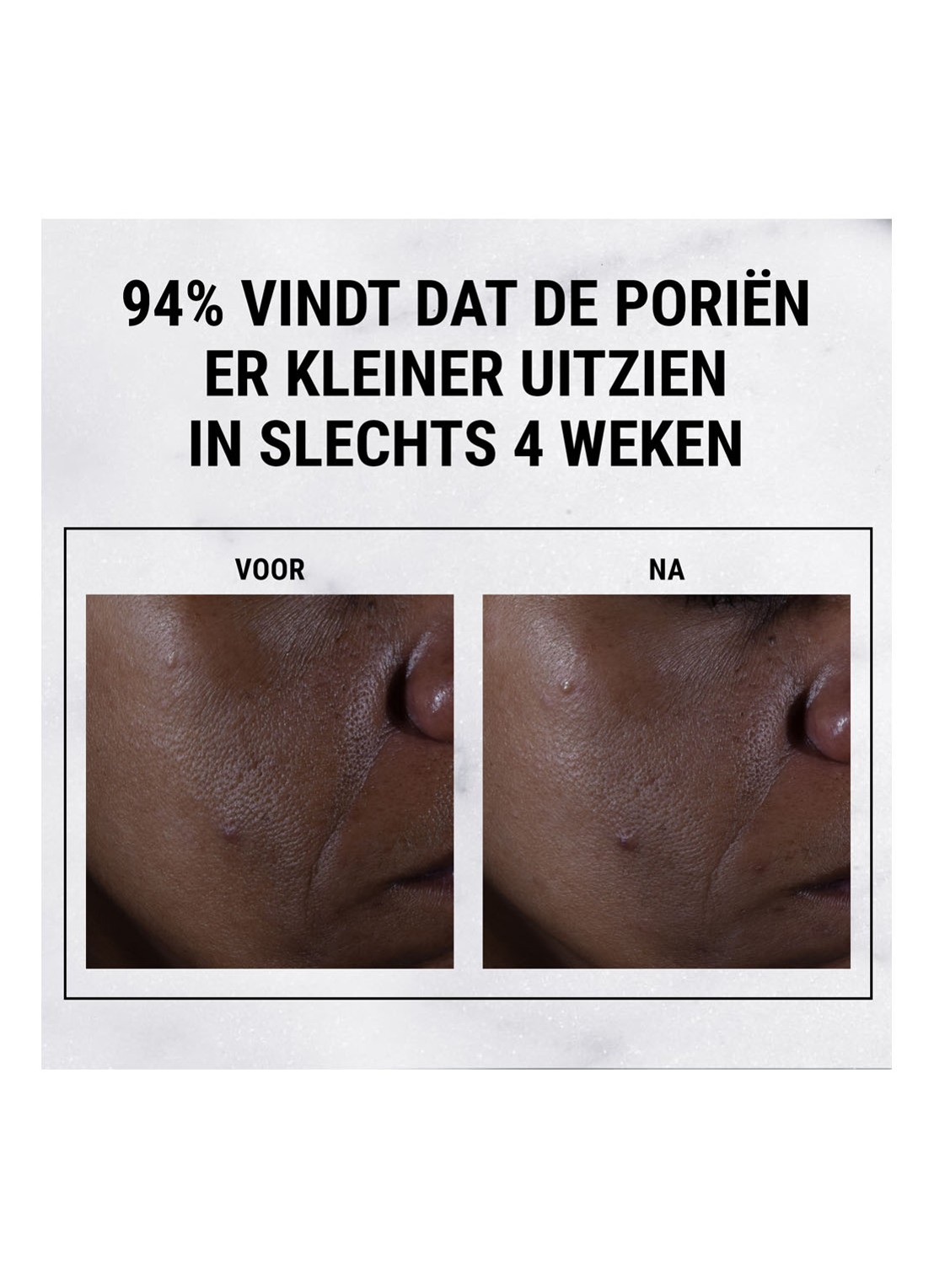Kiehl's Ultra Pure High-Potency 9,8% Glycolic Acid Serum - detail 4 undefined