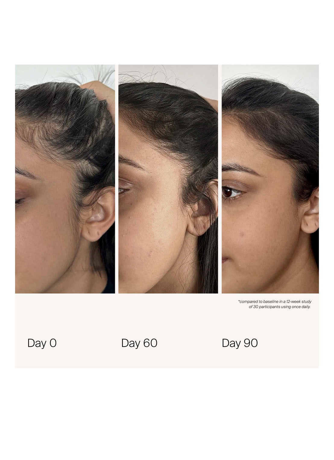 Living Proof Scalp Density Serum - hoofdhuid serum - detail 3 undefined