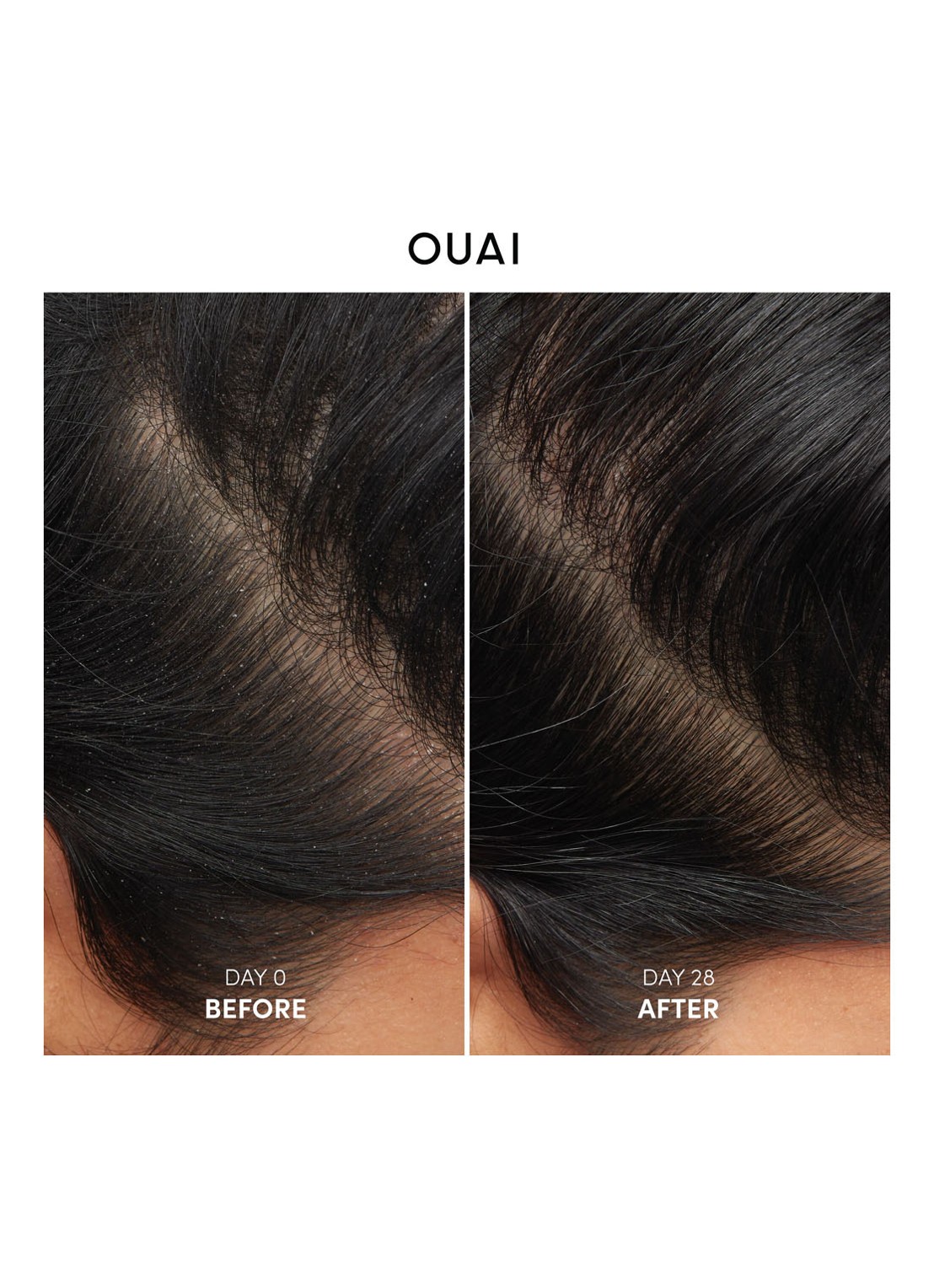 OUAI Anti-Dandruff Shampoo  - anti-roos shampoo - detail 3 undefined