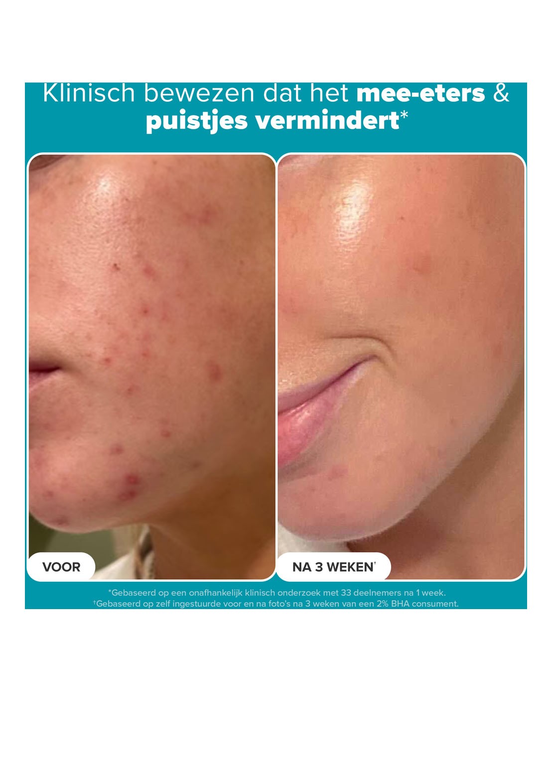 Paula's Choice Skin Perfecting 2% BHA Liquid Exfoliant - exfoliant - detail 7 undefined