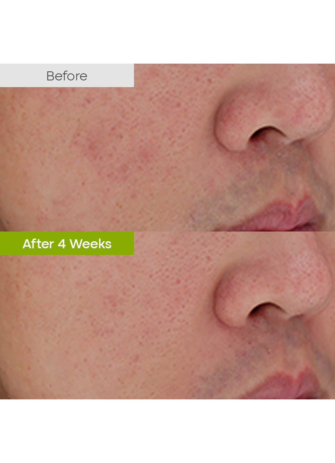 Purito Clear Code Superfruit Cleanser - reinigingsschuim - detail 4 undefined