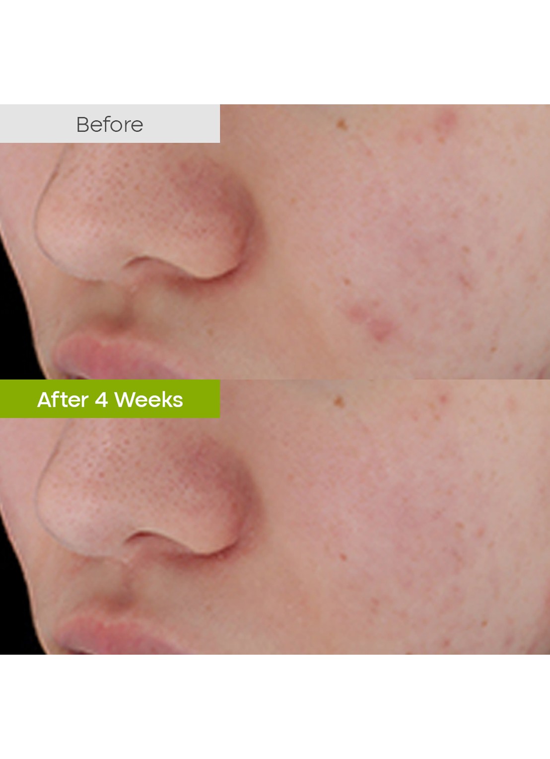 Purito Clear Code Superfruit Serum - detail 4 undefined