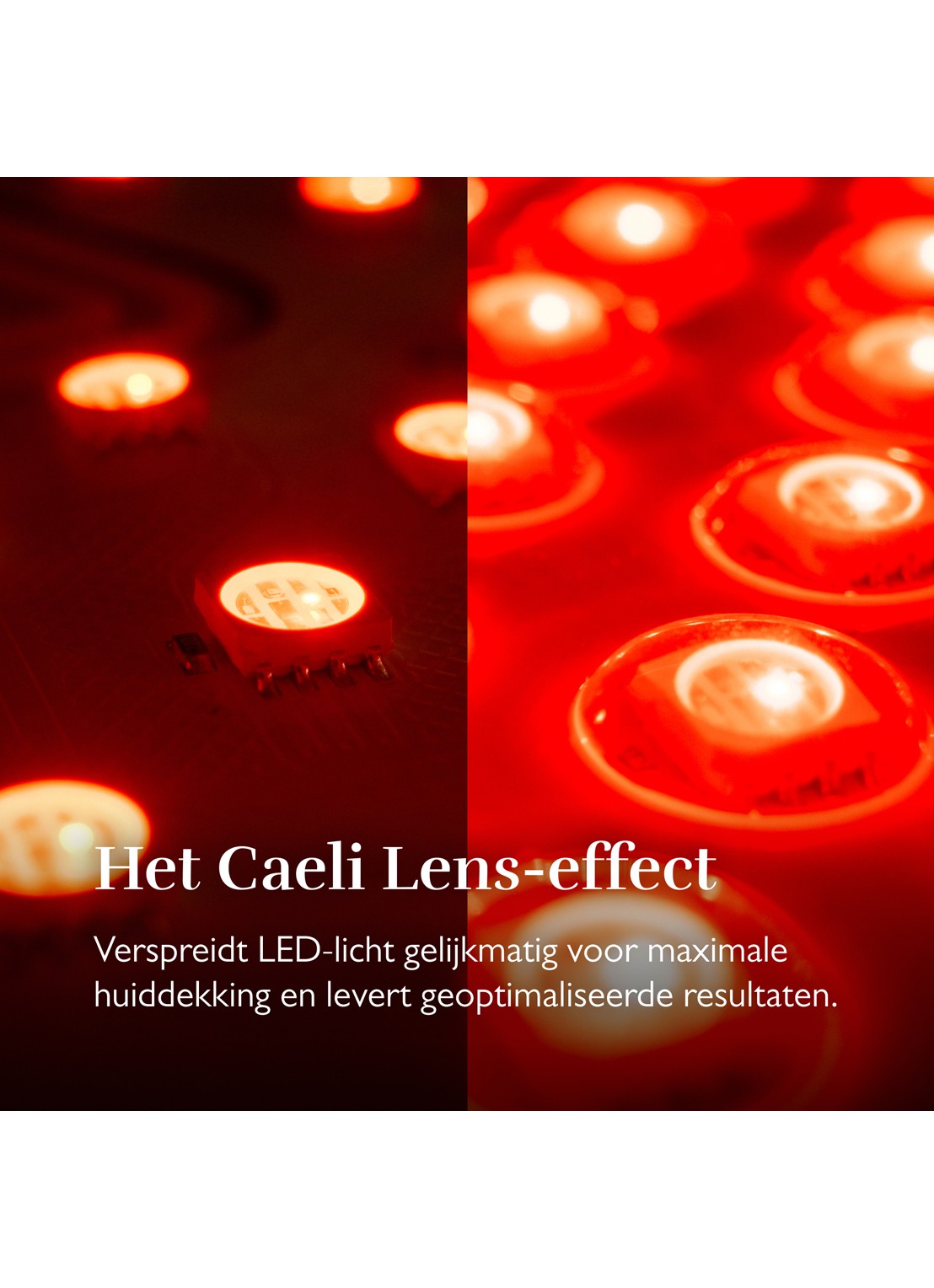 Silk'n LED Chest mask - lichttherapie masker - detail 6 undefined