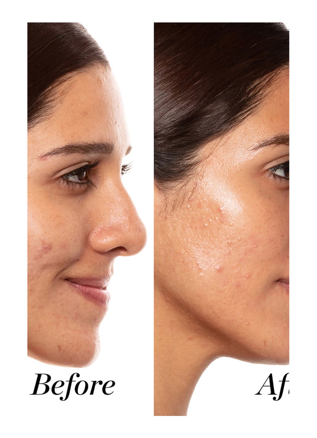 Sunday Riley A+ High-Dose Retinoid Serum - detail 4 undefined