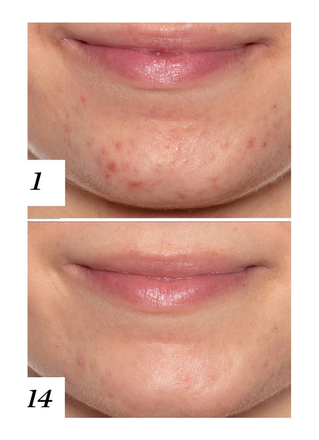 Sunday Riley U.F.O. Ultra Clarifying Treatment Face Oil - gezichtsolie - detail 5 undefined