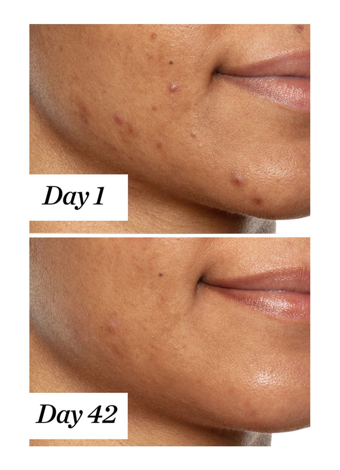 Sunday Riley U.F.O. Ultra Clarifying Treatment Face Oil - gezichtsolie - detail 6 undefined