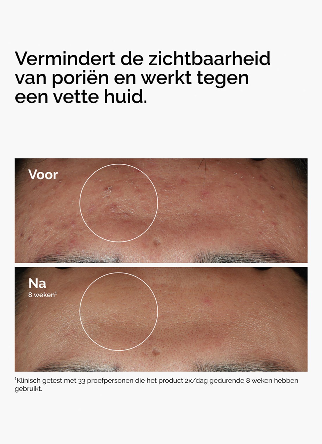 The Ordinary Niacinamide 10% + Zinc 1% - zuiverend serum - achterkant 9 undefined