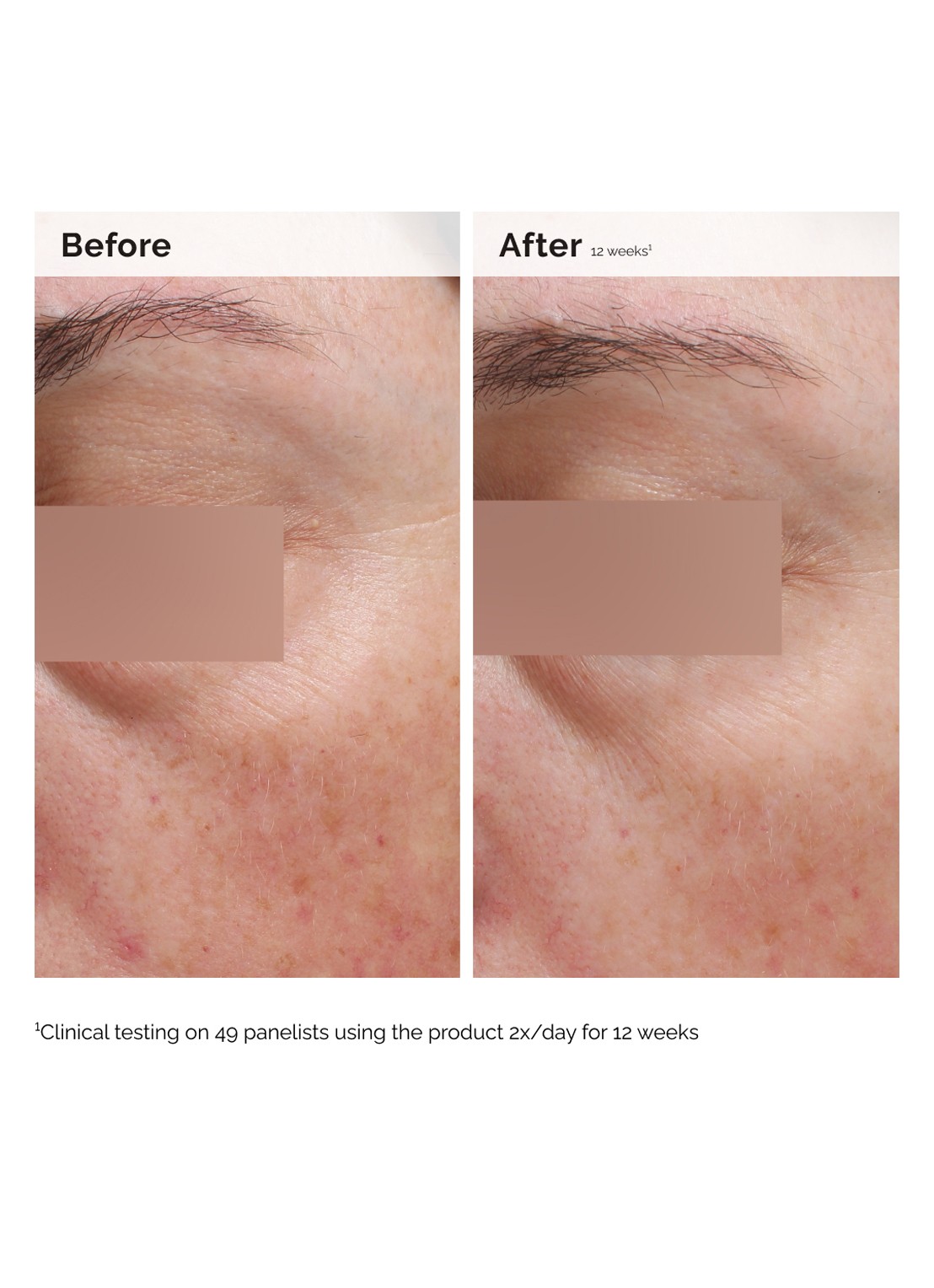 The Ordinary Niacinamide 5% Face & Body Emulsion - gezichts- en lichaamsserum - achterkant undefined