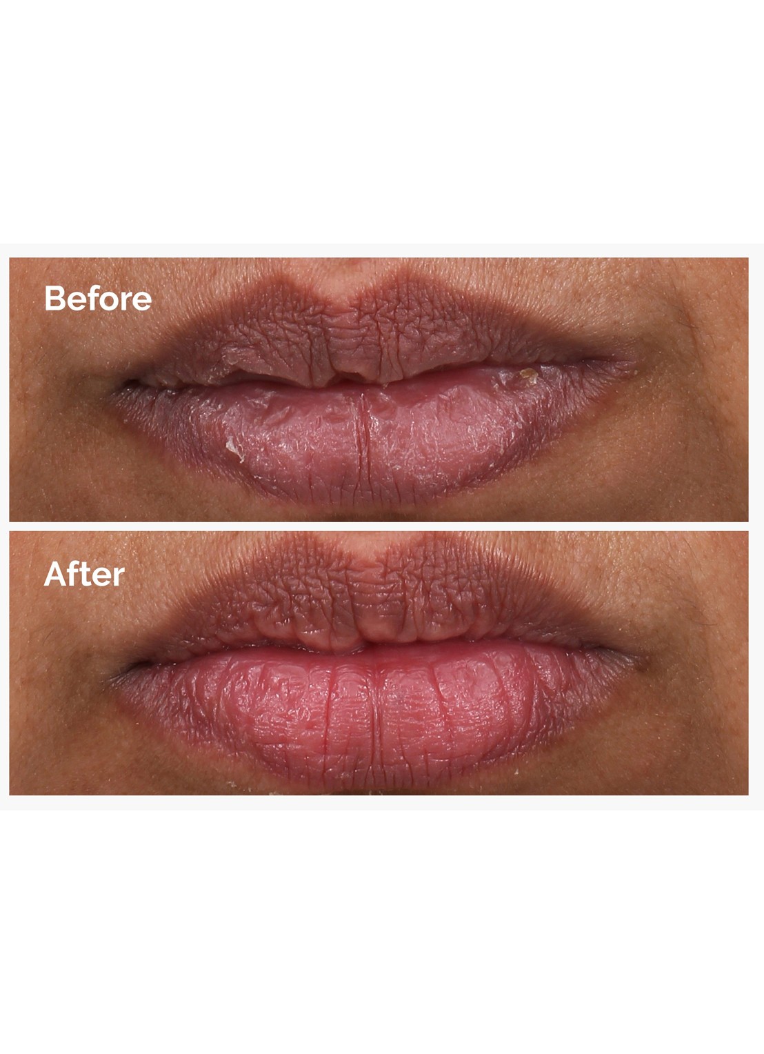 The Ordinary PHA 5% Exfoliating Lip Serum - Lipserum - detail 3 undefined