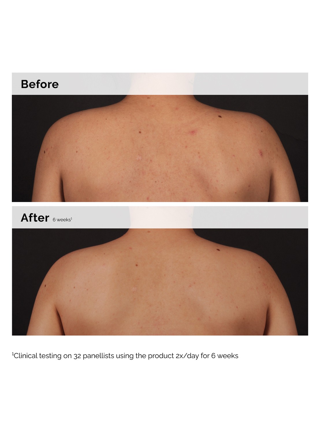 The Ordinary Salicylic Acid 0.5% Body Serum - lichaamsserum - achterkant undefined