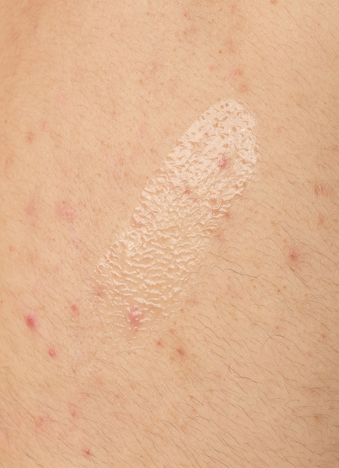 The Ordinary Salicylic Acid 0.5% Body Serum - lichaamsserum - detail 5 undefined