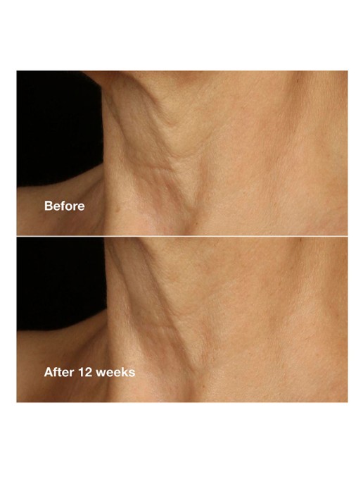 Clinique Clinique Smart Clinical Repair™ Lifting Face + Neck Cream - dagcrème - detail 3 undefined