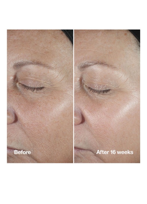 Clinique Smart Clinical Repair™ Wrinkle Correcting Serum - Limited Edition serum - detail 3 undefined