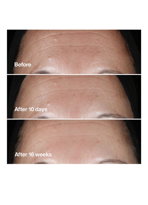 Clinique Smart Clinical Repair™ Wrinkle Correcting Serum - Limited Edition serum - detail 4 undefined