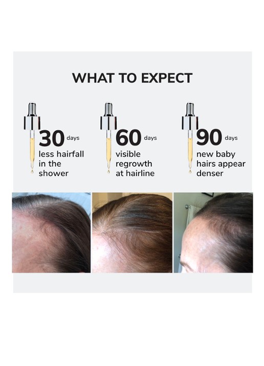 Color Wow Youth Juice Scalp Serum - hoofdhuid serum - detail 7 undefined