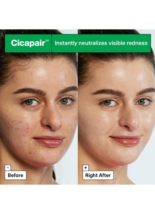 Dr. Jart+ CICAPAIR™ Tiger Grass Color Correcting Treatment - detail 4 undefined