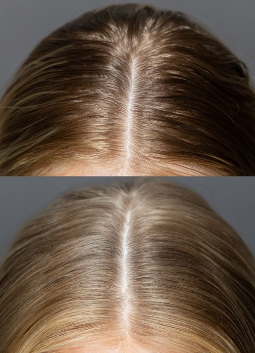 Feather Women Healthy Hair Dry Shampoo - droogshampoo - detail 3 undefined