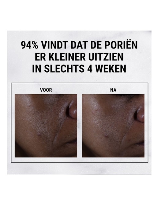 Kiehl's Ultra Pure High-Potency 9,8% Glycolic Acid Serum - detail 4 undefined