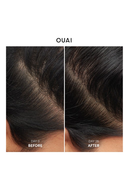 OUAI Anti-Dandruff Shampoo  - anti-roos shampoo - detail 3 undefined