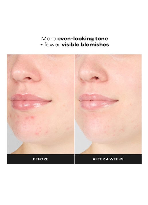 Paula's Choice 1% BHA Gentle Exfoliating Gel Toner - exfoliant - detail 5 undefined