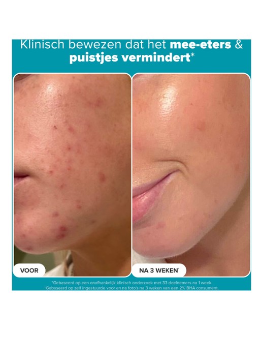 Paula's Choice Skin Perfecting 2% BHA Liquid Exfoliant - exfoliant - detail 7 undefined