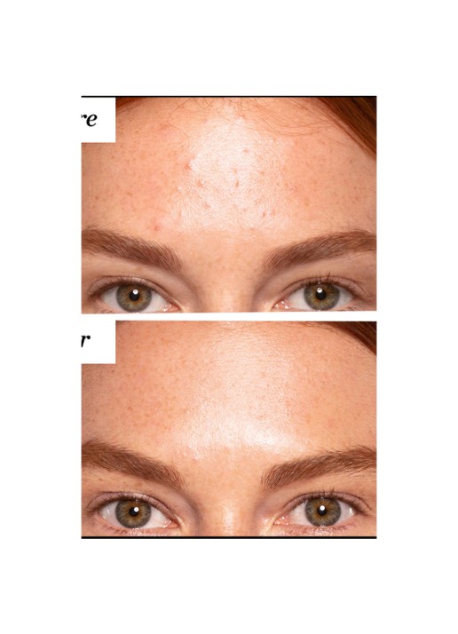 Sunday Riley A+ High-Dose Retinoid Serum - detail 3 undefined