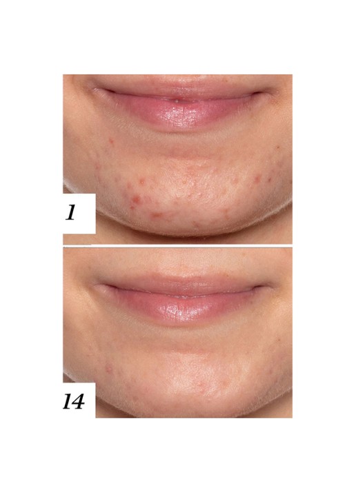 Sunday Riley U.F.O. Ultra Clarifying Treatment Face Oil - gezichtsolie - detail 5 undefined