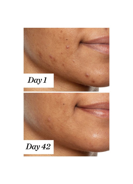 Sunday Riley U.F.O. Ultra Clarifying Treatment Face Oil - gezichtsolie - detail 6 undefined