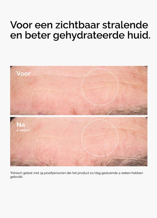 The Ordinary Bigger Hyaluronic Acid (HA) 2% + B5 - hydraterend serum - achterkant 8 undefined