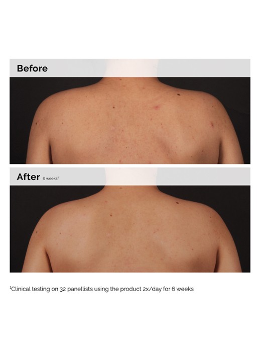 The Ordinary Salicylic Acid 0.5% Body Serum - lichaamsserum - achterkant undefined