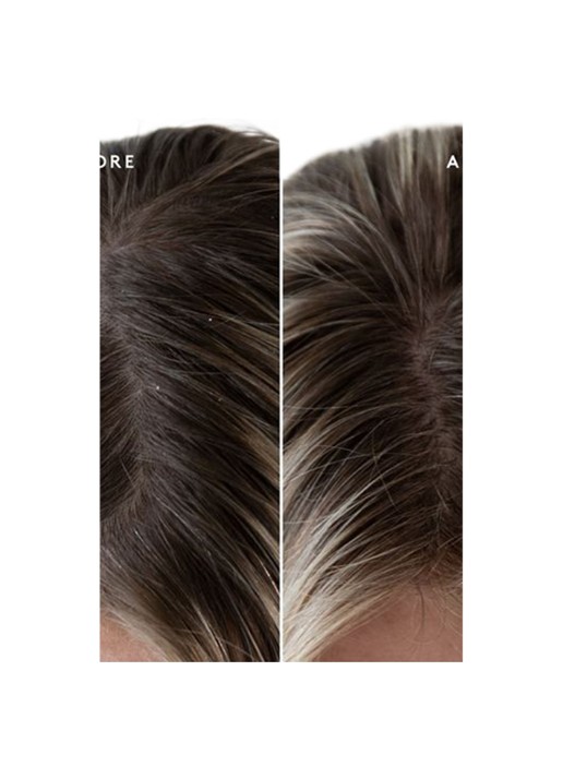 Virtue Exfoliating Scalp Treatment - hoofdhuid exfoliant - detail 2 undefined